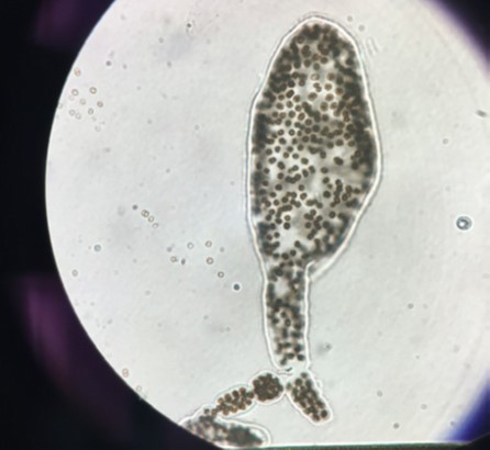 Blue-green algae Microcystis from Calaveras Reservoir, as viewed by microscope
