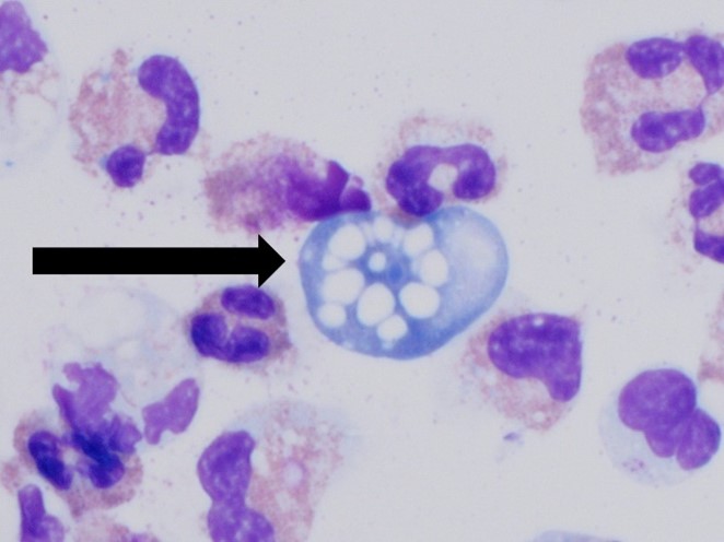 N. fowleri, as viewed by microscope